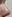 鼻尖形成術（自家軟骨移植） — グナル美容外科クリニック