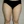 Full-body liposuction — before (21days) · Aurora Clinic