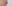 歯列矯正（矯正歯科） — セラミック歯科クリニック