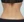 Radiofrequency fat reduction — abdomen — after (17days) · BLS Clinic - Main Branch