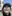 Bulbous nose correction (surgical nasal tip reduction) — Yuno Plastic Surgery