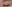 二重まぶた（自然癒着法） — ルホ美容外科クリニック