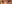 裏ハムラ法（経結膜的眼窩脂肪移動術） — プレジャー美容外科クリニック
