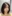 鼻尖形成術（自家軟骨移植） — ウォント美容外科クリニック