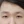 สักขอบตากึ่งถาวร (semi-permanent eyeliner) — ก่อนทำ · คลินิก Mikae