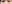 裏ハムラ法（経結膜的眼窩脂肪移動術） — オブジェ美容外科クリニック
