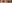 二重まぶた（自然癒着法） — リンク美容外科クリニック