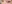 裏ハムラ法（経結膜的眼窩脂肪移動術） — プレジャー美容外科クリニック
