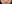 裏ハムラ法（経結膜的眼窩脂肪移動術） — エイペックス美容外科クリニック