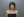 肩部填充（玻尿酸直角肩填充） — 术后 · AVA医美诊所