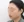 皮質骨切除術（下顎外板骨切り） — 術前 (60日) · アイルミ美容外科クリニック