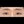 Aegyo-sal filler (under-eye 'love band' / pretarsal roll filler) — before · Pixel Lab Plastic Surgery Clinic