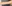 二の腕の脂肪吸引 — ドクターマンゴークリニック