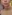 Masseter Botox (jaw slimming / square jaw reduction) — J.Fill Clinic - Gangnam Branch