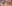 裏ハムラ法（経結膜的眼窩脂肪移動術） — ルホ美容外科クリニック