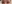 二重まぶた（自然癒着法） — タンキュー美容外科クリニック