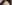 額（おでこ）のヒアルロン酸注入 — フルルン美容外科クリニック