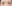 裏ハムラ法（経結膜的眼窩脂肪移動術） — プレジャー美容外科クリニック