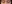 二重まぶた（自然癒着法） — ルホ美容外科クリニック