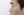 Short nose correction (nose lengthening / derotation) — before (14days) · iLumi Plastic Surgery Clinic