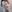 Arm liposuction — Uri Plastic Surgery Clinic