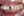รากฟันเทียม — ก่อนทำ (150วัน) · คลินิกทันตกรรม White Dream - สาขากังนัม
