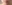 スキンボトックス（マイクロボトックス） — フルルン美容外科クリニック