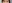 裏ハムラ法（経結膜的眼窩脂肪移動術） — ジャスト美容外科クリニック