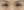 lower blepharoplasty (under-eye bag removal with fat repositioning) — before (7days) · Seoul During Clinic