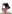 Bulbous nose correction (surgical nasal tip reduction) — Coco Line Clinic
