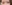 埋没法（二重埋没法） — クッキー美容外科クリニック