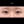 ผ่าตัดแก้ขนตาทิ่มตา (ขนตาแยงตา / เปลือกตาม้วนเข้า) — ก่อนทำ (31วัน) · รพ.ศัลยกรรมตกแต่งโอลโล