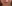 Lip filler (lip augmentation with HA) — Elleve Clinic