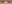 裏ハムラ法（経結膜的眼窩脂肪移動術） — プレジャー美容外科クリニック