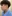Bulbous nose correction (surgical nasal tip reduction) — Uri Plastic Surgery Clinic