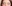 裏ハムラ法（経結膜的眼窩脂肪移動術） — プレジャー美容外科クリニック