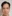 jaw angle reduction (mandibular angle osteotomy) — Uri Plastic Surgery Clinic