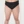 Buttock Liposuction — before (30days) · Body Up Clinic
