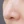 ไฮดร้าเฟเชียล (Aqua Peel ทำความสะอาดรูขุมขน) — หลังทำ · คลินิก Mikae