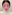 団子鼻修正（鼻尖縮小術） — ララ美容外科クリニック