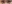 涙袋形成（脂肪注入） — ファクト美容外科クリニック