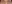 眉毛挙上術（ブロウリフト） — エイペックス美容外科クリニック