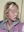 สลายไขมันใบหน้าด้วยเลเซอร์ (AccuSculpt) — ก่อนทำ · ยูไลน์คลินิก