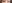 裏ハムラ法（経結膜的眼窩脂肪移動術） — プレジャー美容外科クリニック
