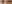 裏ハムラ法（経結膜的眼窩脂肪移動術） — ムイ美容外科クリニック