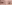 眼瞼下垂手術（目つき矯正） — Unique Plastic Surgery Clinic