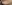 涙袋ヒアルロン酸注入（涙袋形成） — ドレス美容外科クリニック