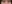 裏ハムラ法（経結膜的眼窩脂肪移動術） — ハッシュ美容外科クリニック