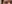 眉毛挙上術（ブロウリフト） — エイペックス美容外科クリニック