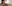 顔の脂肪溶解注射（小顔注射） — ロリポップ美容外科クリニック